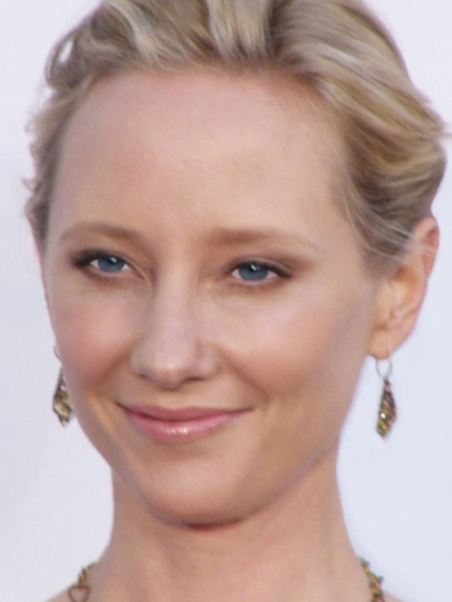 Anne Heche Hospitalized After Car Crash